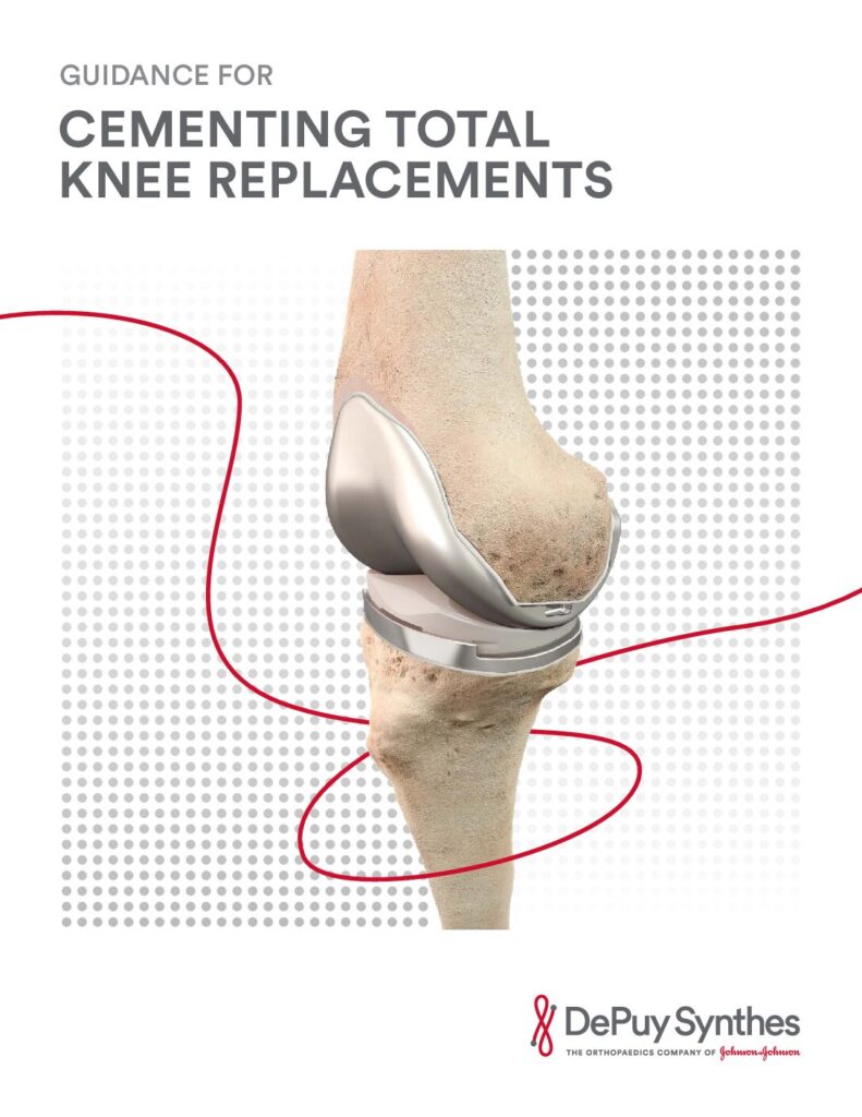 Guidance For Cementing Total Knee Replacements