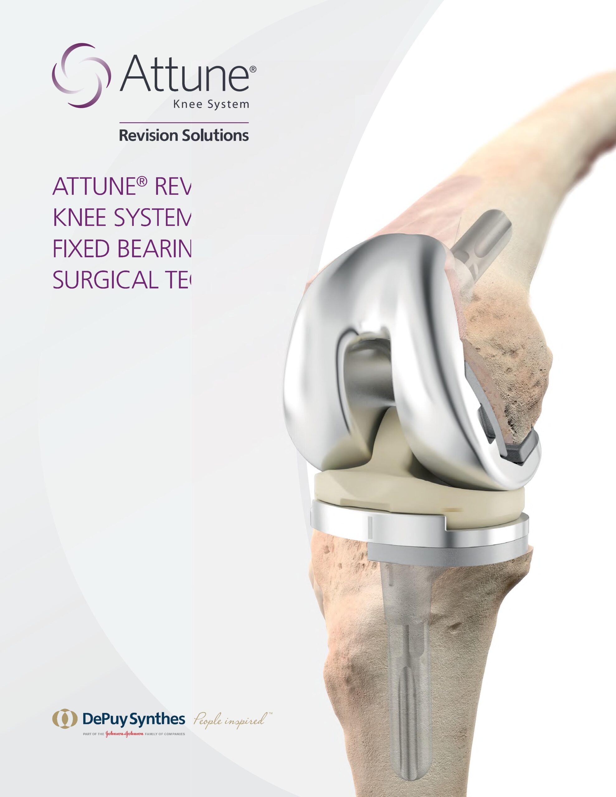 Attune Knee Revision Fixed