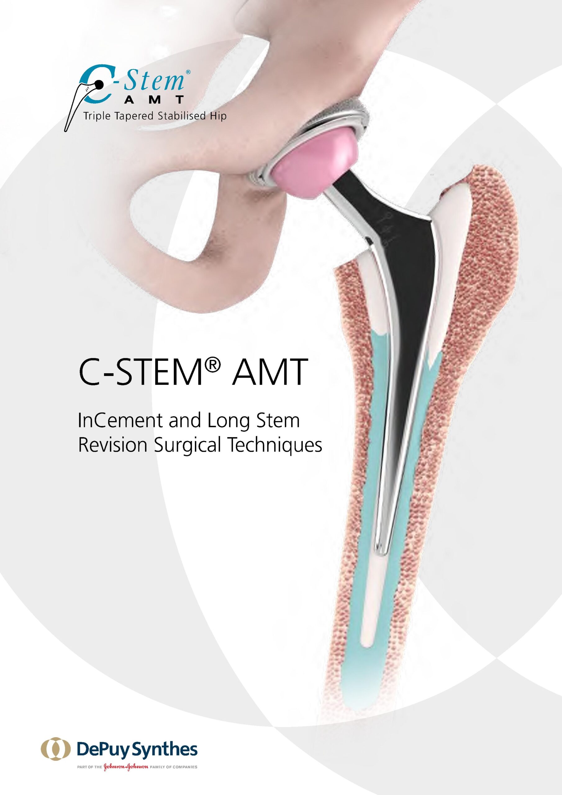 C-Stem AMT