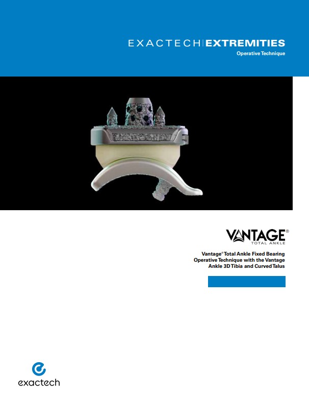 Vantage Total Ankle Replacement fixed Bearing